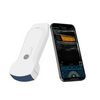 Dual-Head Portable Wireless Probe Color Doppler Ultrasound Scanner
